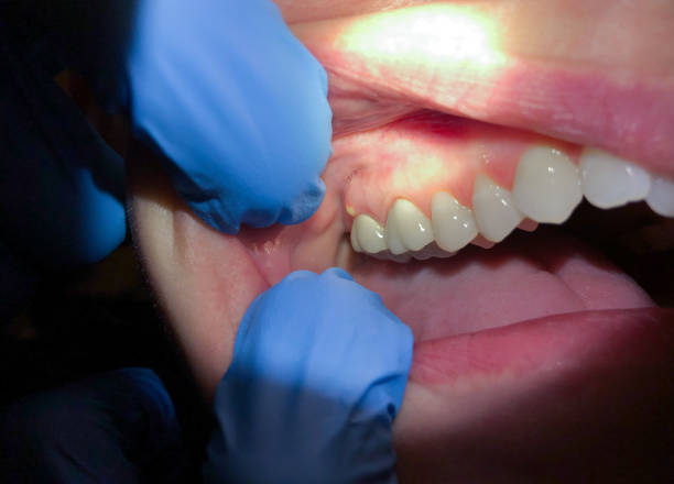 Best Pediatric Emergency Dentist in White Hall, WV